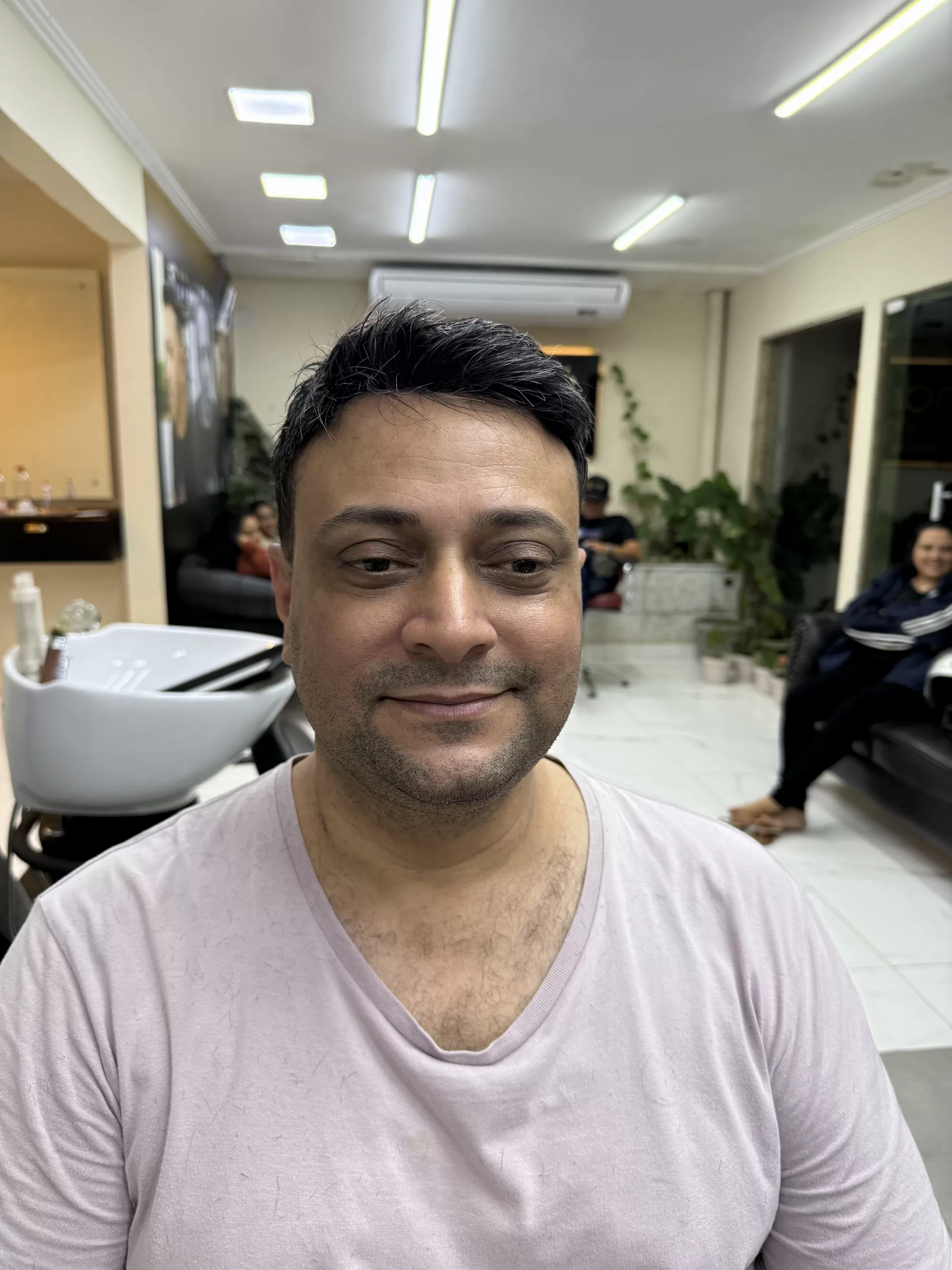 Depois — Estava ficando careca no topo e saiu com o cabelo cheio no mesmo dia: prótese capilar masculina que parece de verdade, em Magé/RJ.