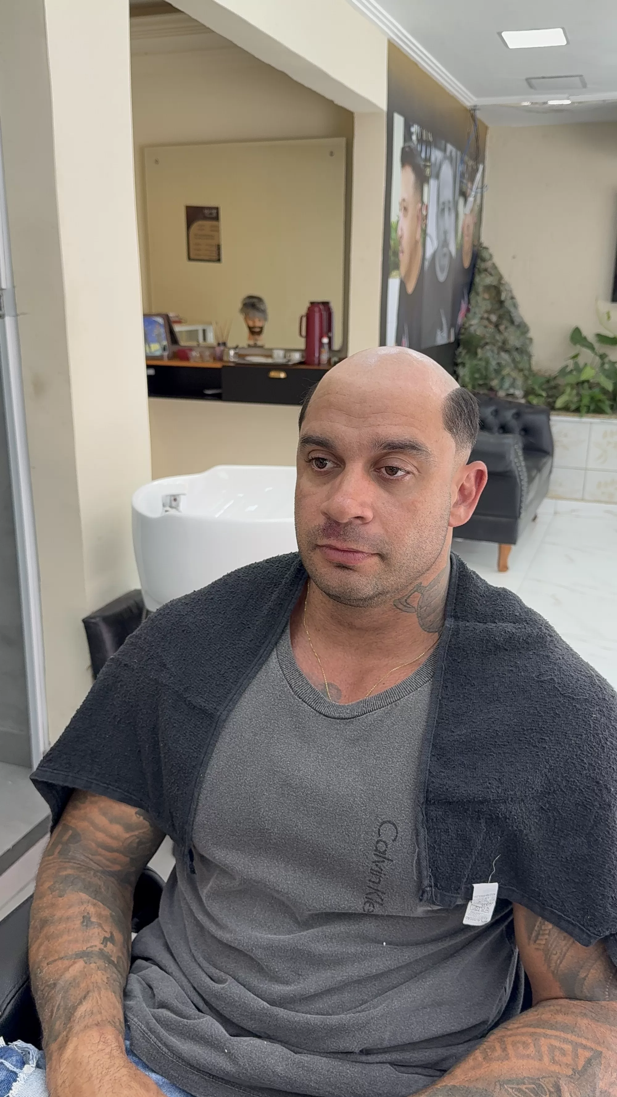 Antes — Tinha entradas e pouco cabelo, agora está com cabelo cheio e um corte moderno: prótese capilar masculina, sem cirurgia e sem dor.