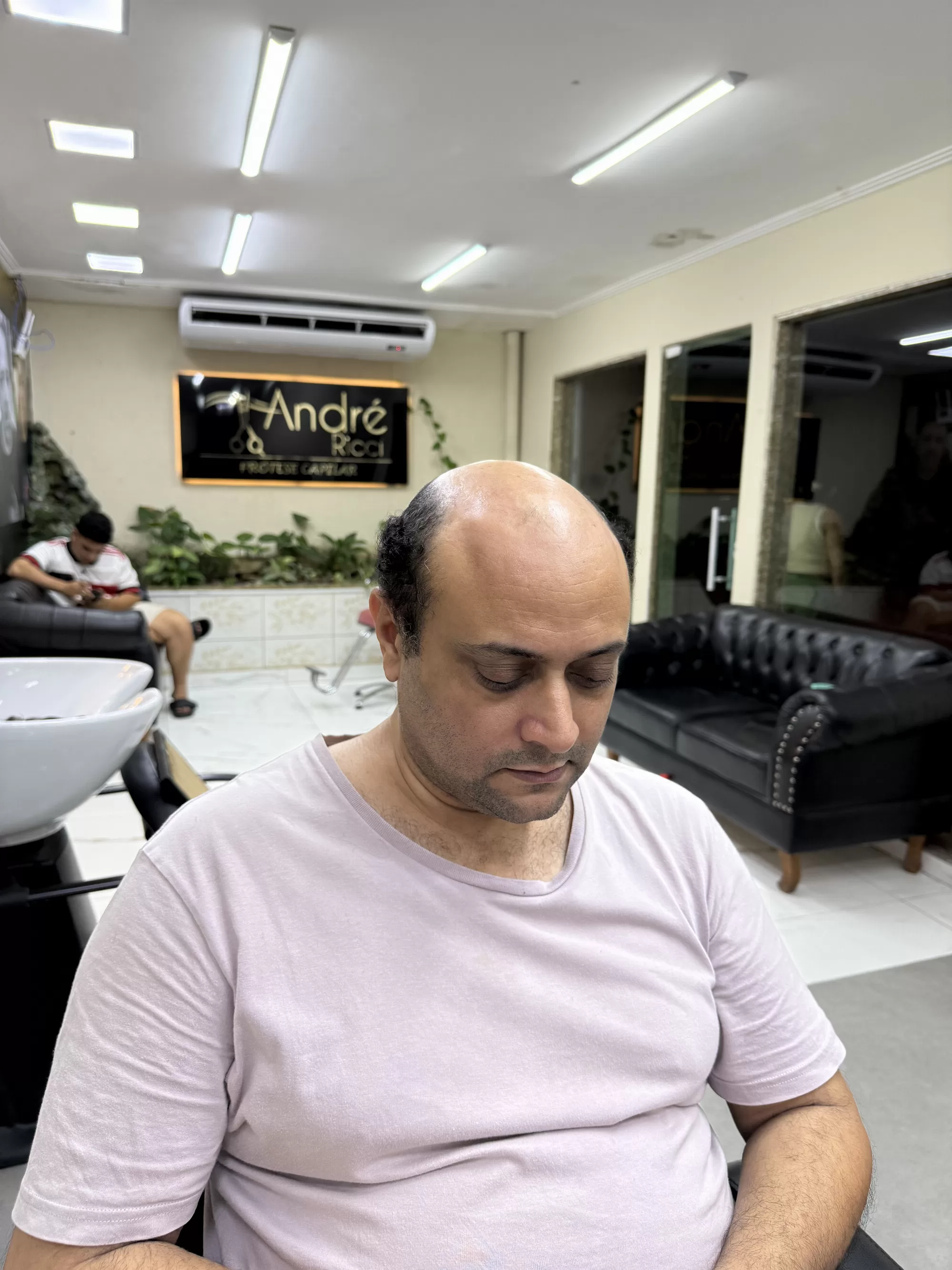 Antes — Estava ficando careca no topo e saiu com o cabelo cheio no mesmo dia: prótese capilar masculina que parece de verdade, em Magé/RJ.