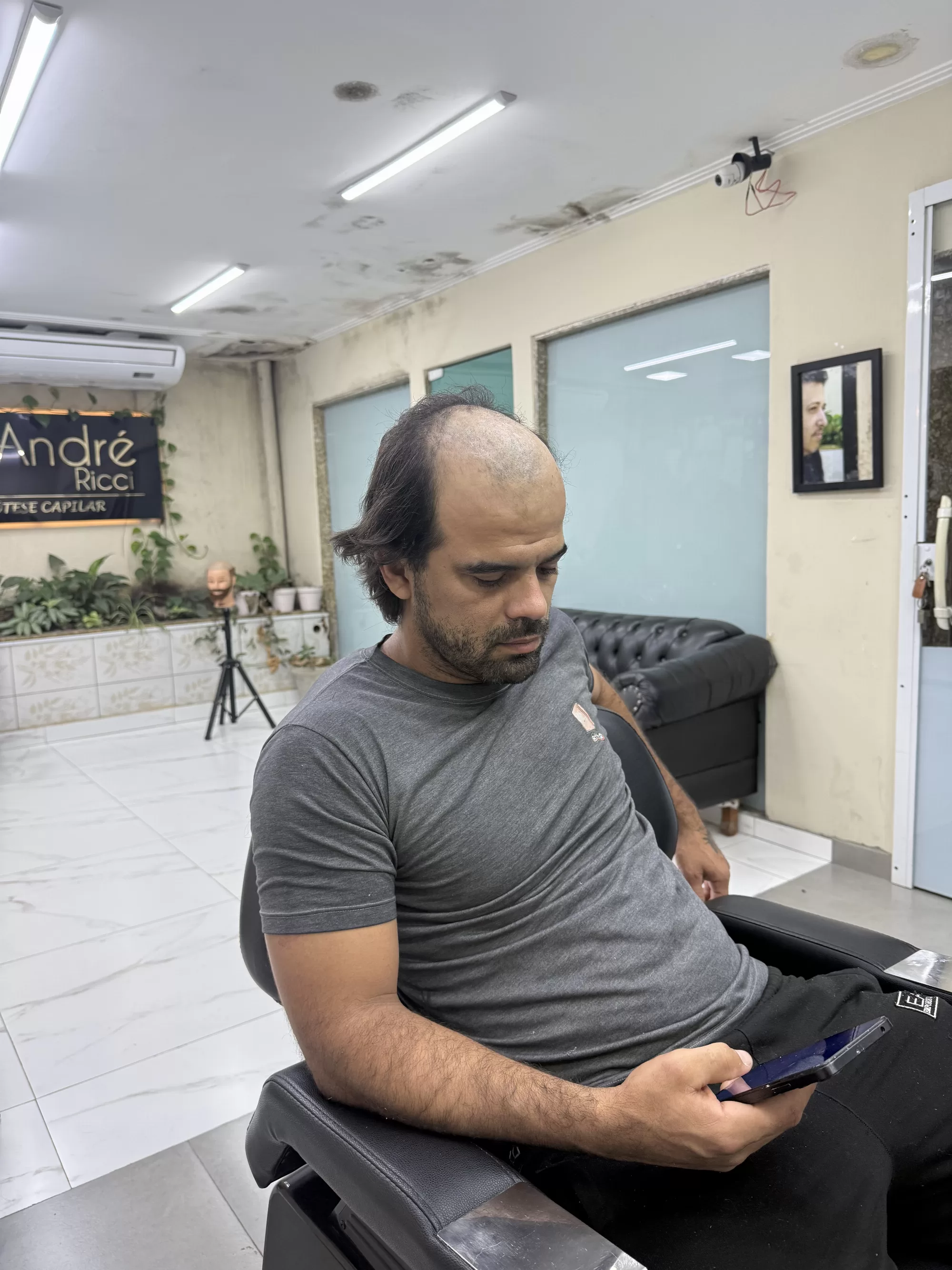 Antes — Cabelo cheio no topo e corte estiloso para quem estava perdendo cabelo: prótese capilar masculina com visual moderno.