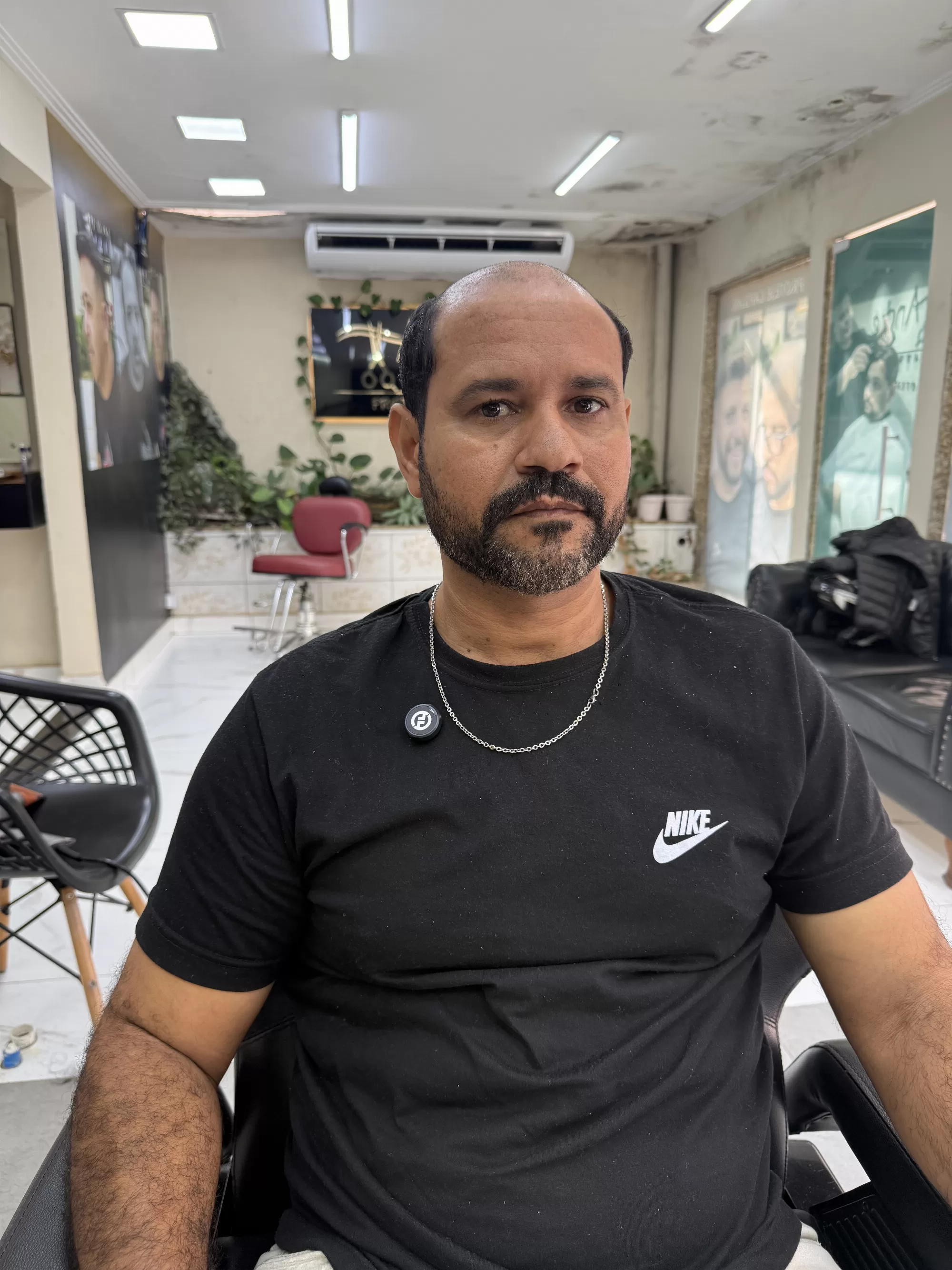 Antes — Cobriu a careca do topo com cabelo que parece de verdade: prótese capilar masculina, visual renovado e mais jovem, sem cirurgia.