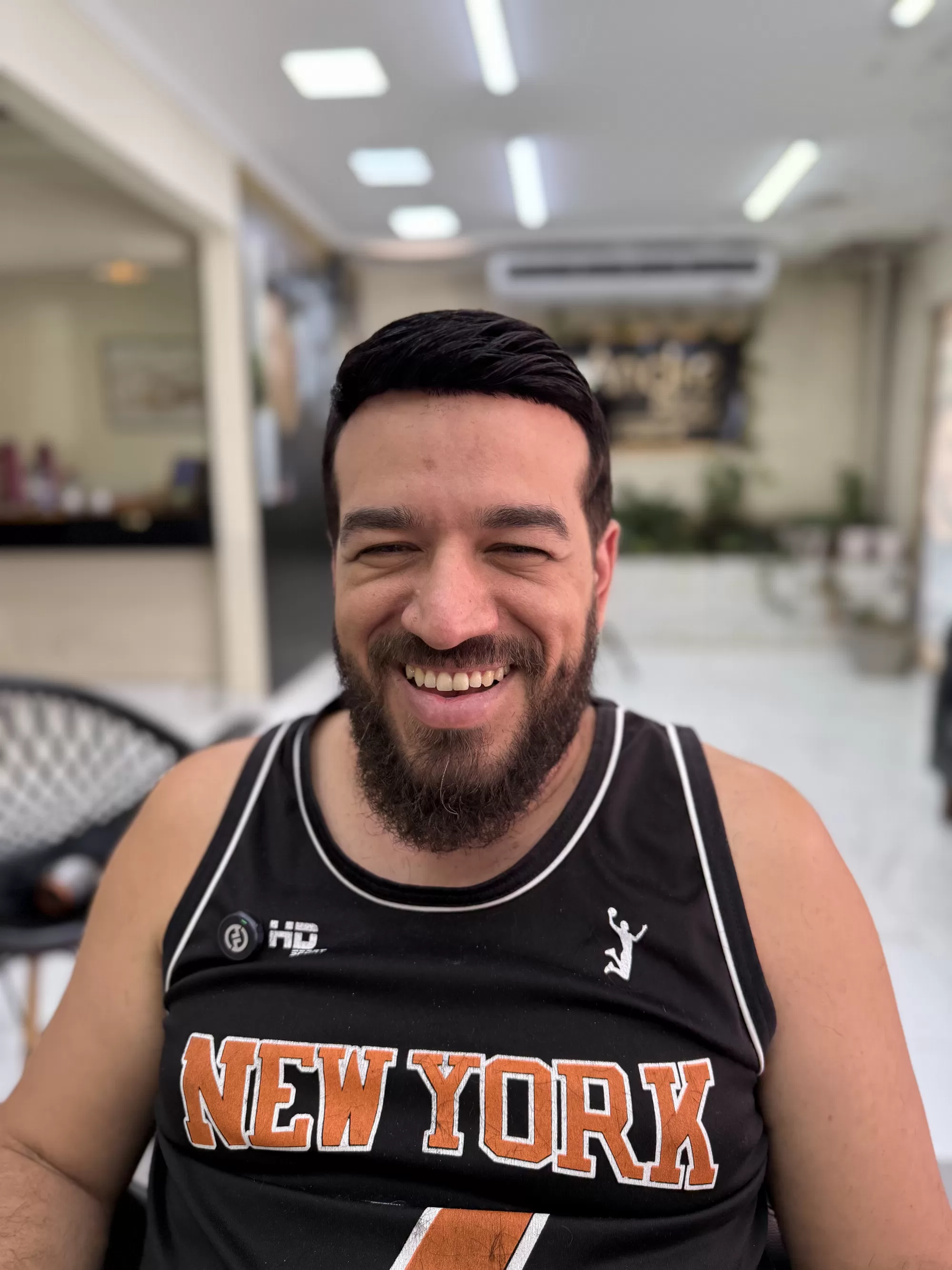 Depois — Estava careca no topo e saiu com o cabelo cheio e sorrindo: prótese capilar masculina com resultado natural, aqui no RJ.