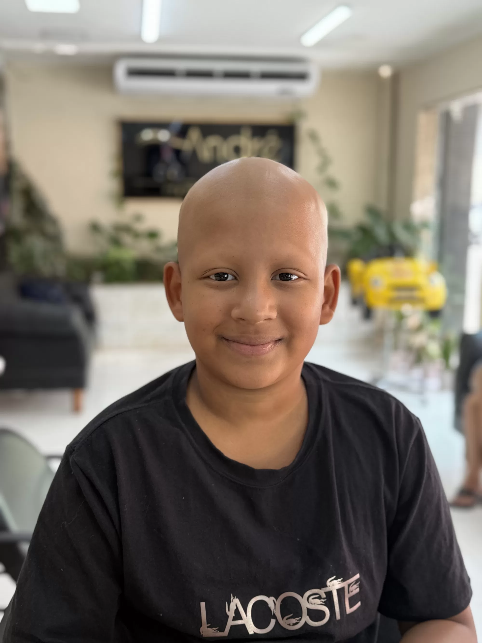 Antes — Prótese de cabelo para quem tem alopecia: o cabelo natural de volta e, junto, o sorriso e a confiança. Estúdio André Ricci.