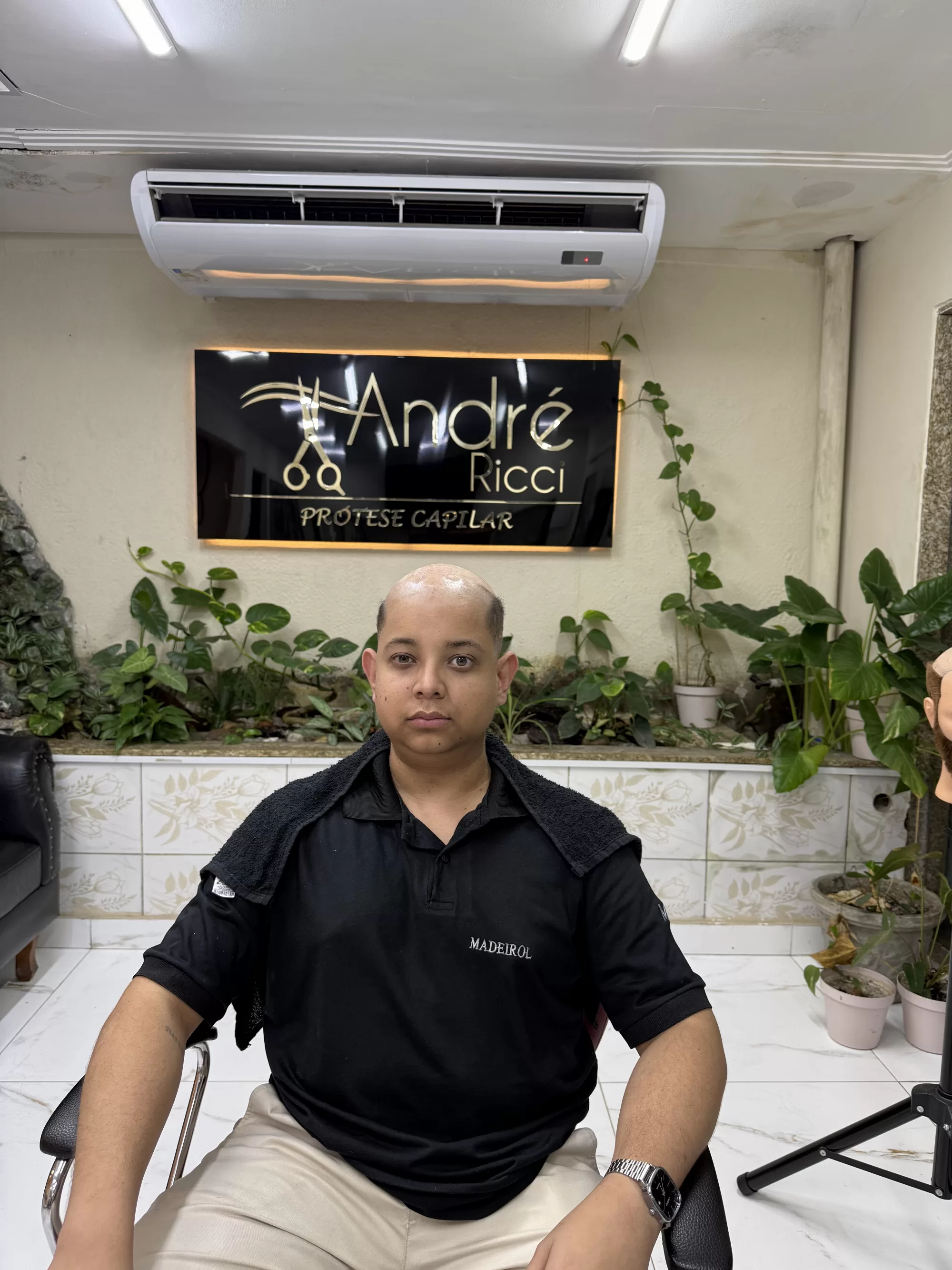 Antes — Estava com a cabeça raspada e voltou a ter cabelo cheio: prótese capilar masculina que transforma o visual e a autoestima. André Ricci, RJ.
