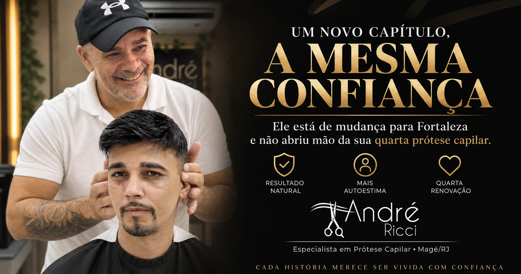 Quarta prótese capilar acompanha nova fase em Fortaleza