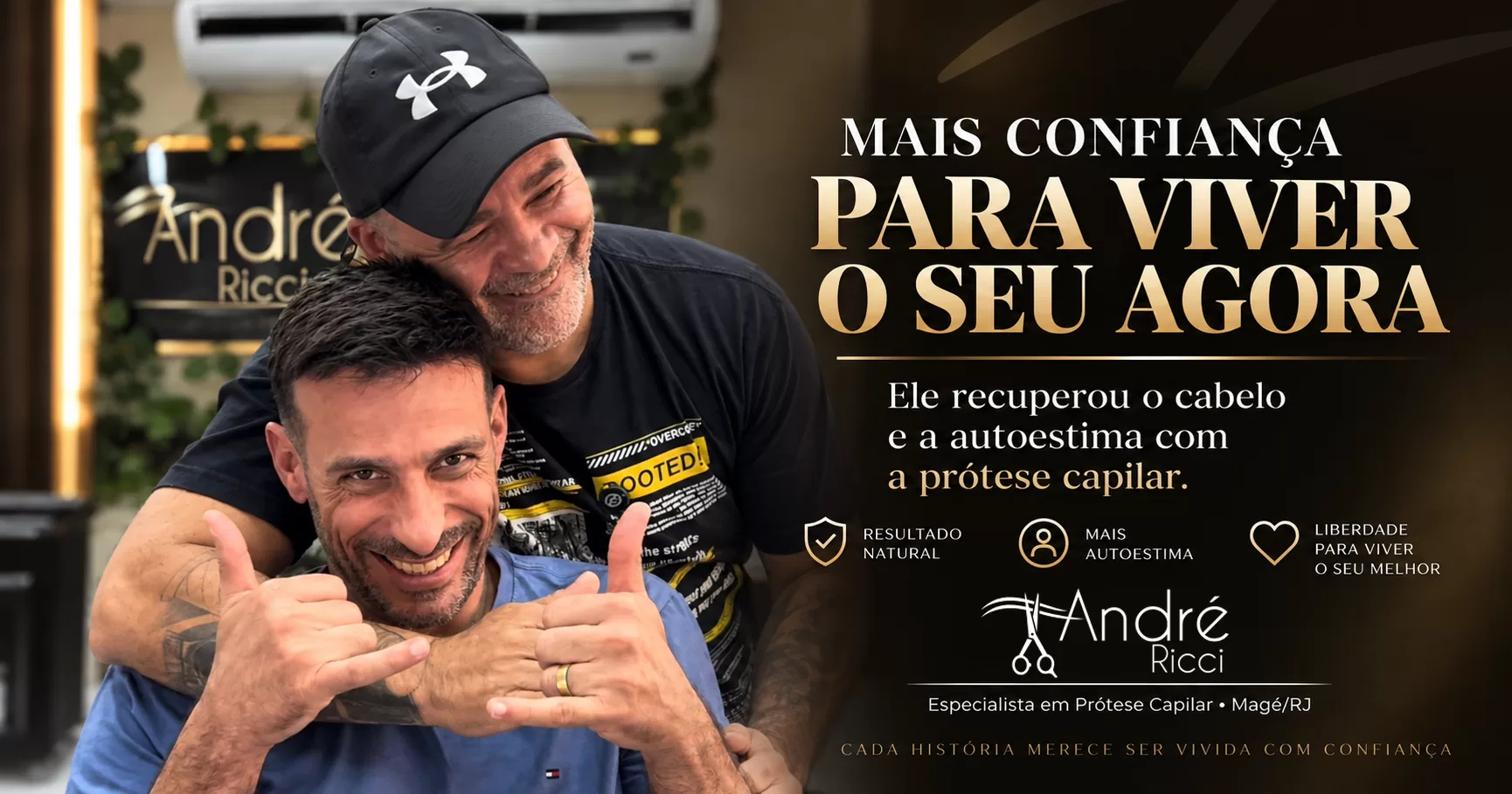 Prótese capilar aos 44 anos: a experiência de João após 8 meses de uso